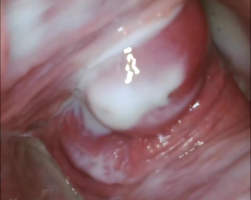 Latina amateur uses a speculum to show up close of her creamy pussy