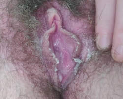 Smegma covered unwashed hairy pussy